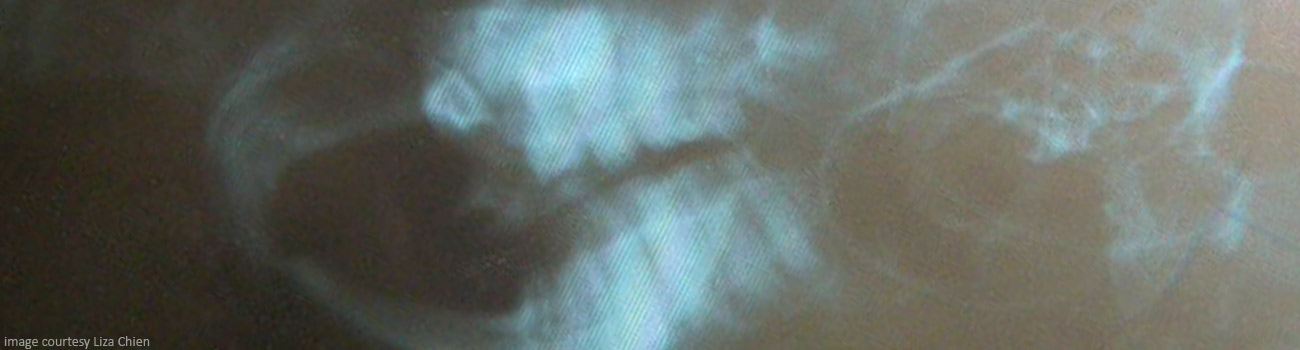 Feature Image for Chinchilla Malocclusion - A Polygenic Trait